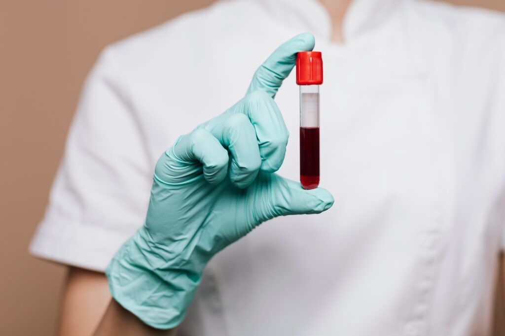 A veterinary technician at Crossroads Veterinary Clinic in Bellevue holds a blood sample tube during Bellevue veterinary diagnostics lab testing.
